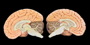 gray matter