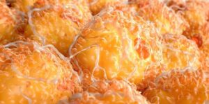 Lipid