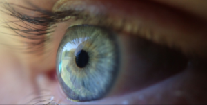 Vision